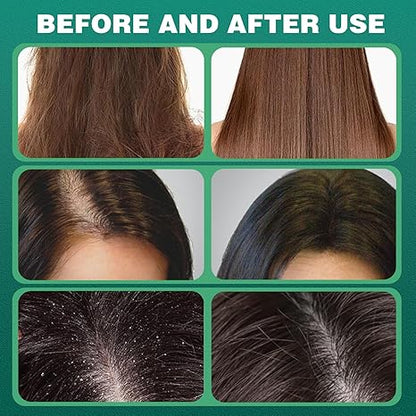 “Nature Seven Green Herbal Shampoo Bar – Hair Strengthening & Smoothing”